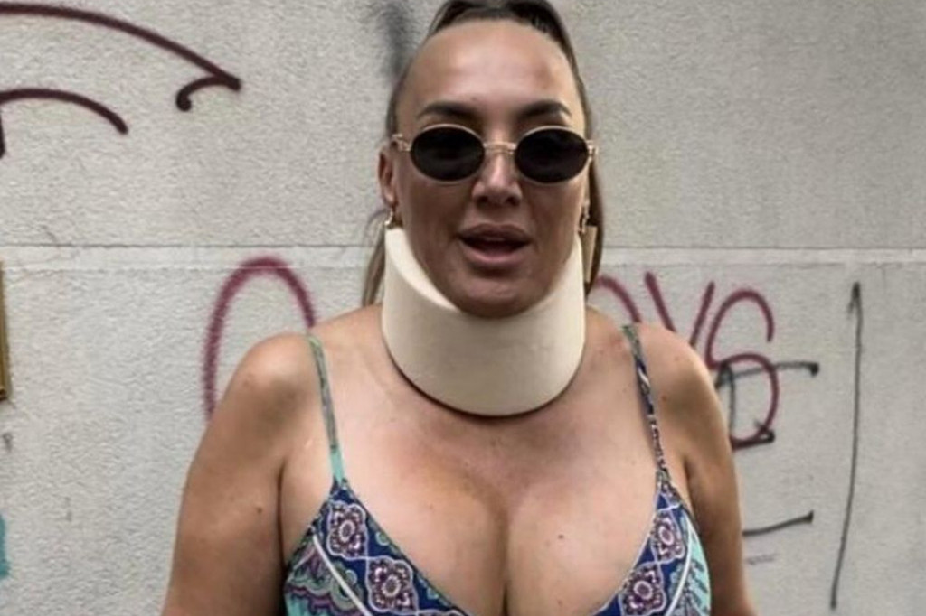 Prva fotografija Goge Sekulić nakon udesa: Ostao mi je urezan hladan pogled vozača koji me je udario Prva fotografija Goge Sekulić nakon udesa: Ostao mi je urezan hladan pogled vozača koji me je udario