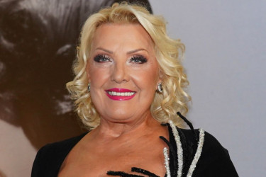 Uradila sam samo jedan, jedini zahvat na licu: Snežana Đurišić otkriva istinu o estetskim korekcijama Uradila sam samo jedan, jedini zahvat na licu: Snežana Đurišić otkriva istinu o estetskim korekcijama